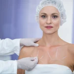 rejuvenecimiento-de-escote rejuvenecimiento-de-escote