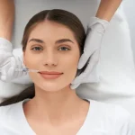 retirada-con-hialuronidasa aumento de labios en madrid