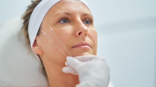 servicios-hilos-sensores servicios-hilos-sensores