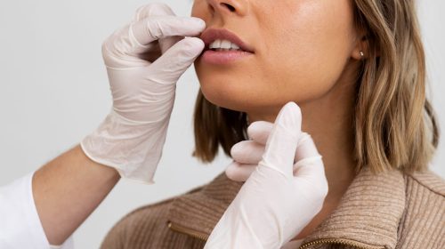 servicios-labios servicios-labios